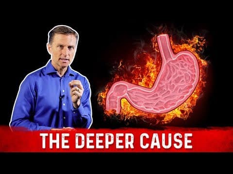 The Real Causes of Acid Reflux, Heartburn & GERD – Dr.Berg thumbnail