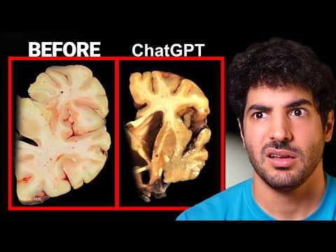 It's Official: ChatGPT is Making You Dumb thumbnail