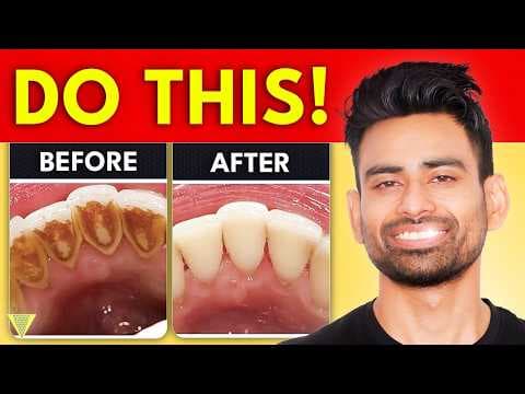 How to Remove Dental Plaque & Prevent Cavities? thumbnail