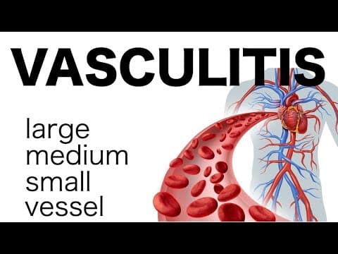 Vasculitis thumbnail