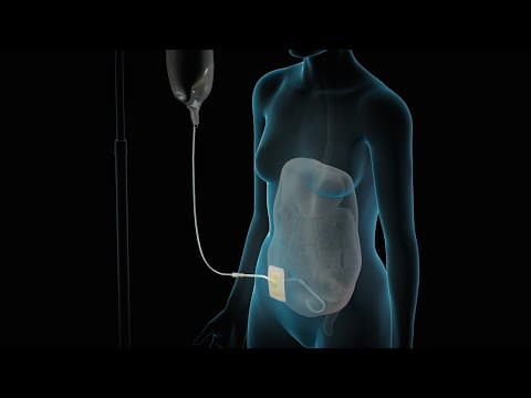 Dialysis | Nucleus Health thumbnail