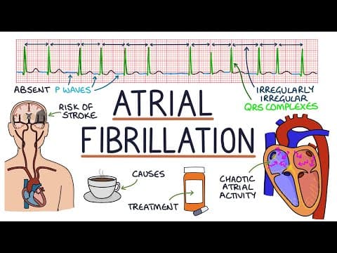 Understanding Atrial Fibrillation thumbnail
