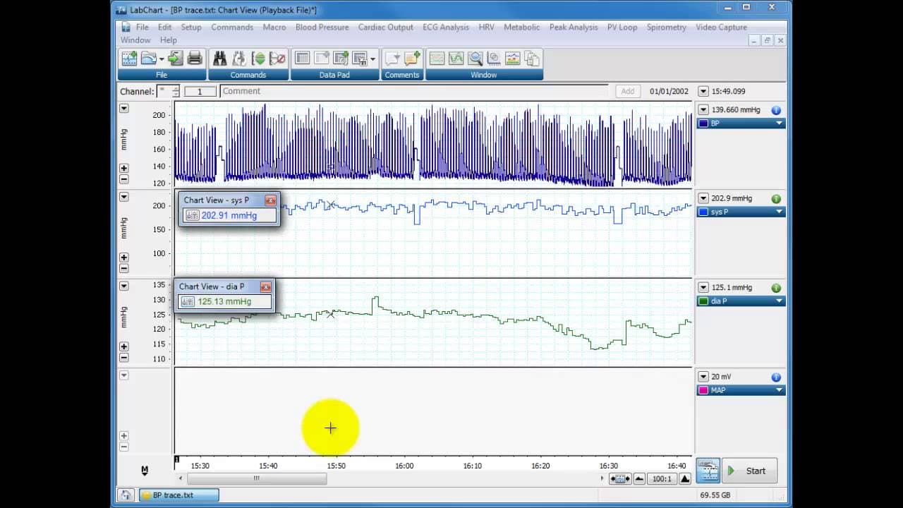 YouTube video player