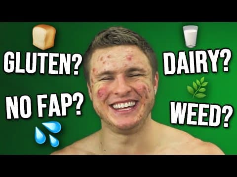 Does THIS Cause Acne | ULTIMATE LIST (VAPING, HOT SHOWERS, & MORE!) thumbnail
