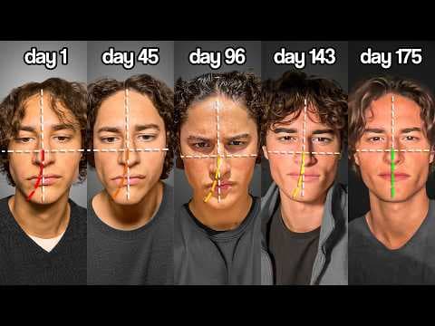 I Spent 175 Days Fixing My Asymmetry | 4-Step Guide thumbnail