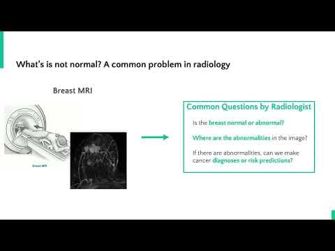 How Can AI Assist in Early Breast Cancer Detection? thumbnail