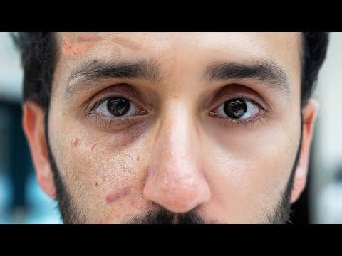 My Evidence-Based Skincare Routine thumbnail