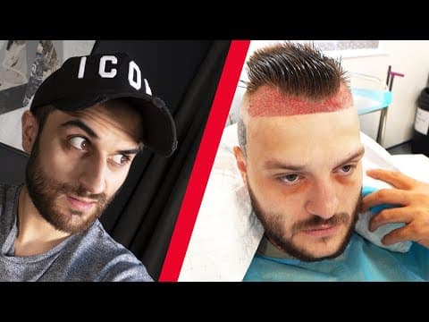 EVERYTHING WRONG WITH TGF DO IT #6 - Hairline Surgery Edition thumbnail