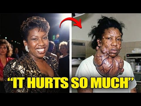 27 Black Celebrities Who Died From Incurable Diseases thumbnail