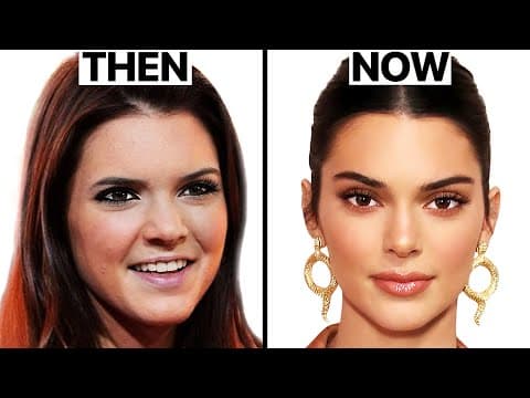 What Happened to Kendall Jenner's Face? | Plastic Surgery Analysis thumbnail