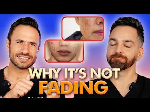 11 Dark Spot & Hyperpigmentation Mistakes Ruining Your Skin thumbnail