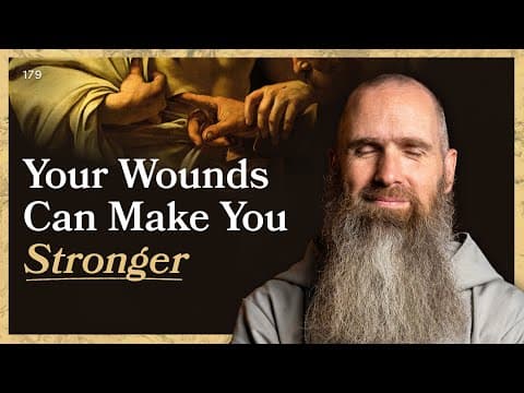 Your Wounds Can Make You Stronger | LITTLE BY LITTLE | Fr Columba Jordan CFR thumbnail