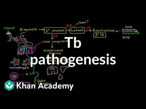 TB pathogenesis | Infectious diseases | NCLEX-RN | Khan Academy thumbnail