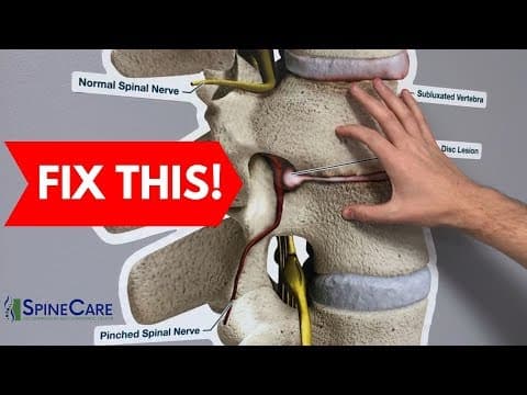 How to Fix a Bulging Disc in Your Lower Back | RELIEF IN SECONDS! thumbnail