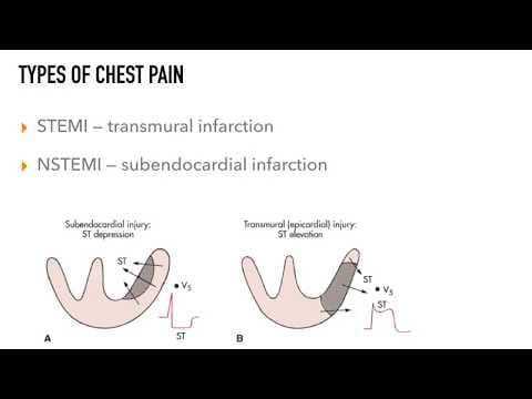 Chest Pain Rapid Review thumbnail