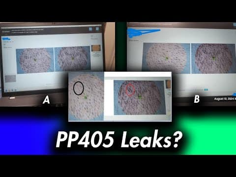 PP405: Hair Loss Drug Phase Two Results Leak? Not Really... thumbnail