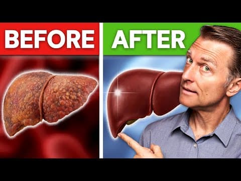 The #1 Best Way to CLEAN a Fatty Liver thumbnail