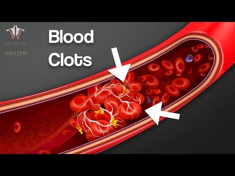 What You NEED to Know About Blood Clots... thumbnail