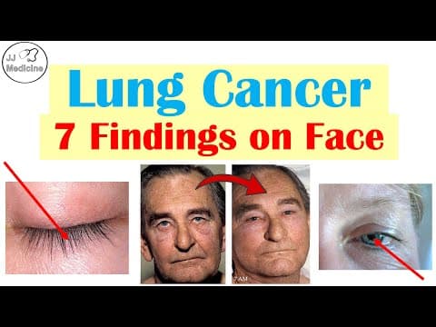 7 Findings on the Face That Can Reveal Lung Cancer Early thumbnail