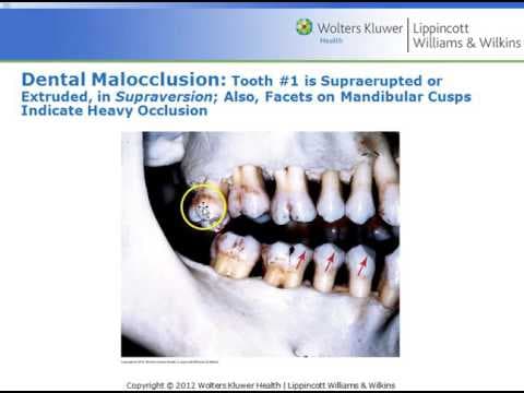 What Is the Importance of Dental Occlusion? thumbnail