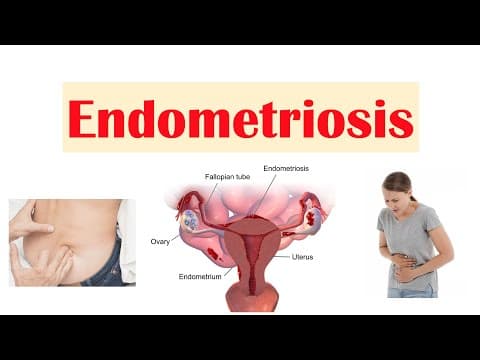 Endometriosis | Causes, Pathophysiology, Symptoms, Diagnosis & Treatment thumbnail