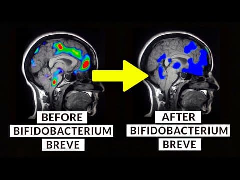 Study Finds The Exact Probiotic To Take For Better Sleep thumbnail