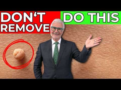 My Skin Tags Dried Up And Fell Off After I Made This One Lifestyle Change! thumbnail
