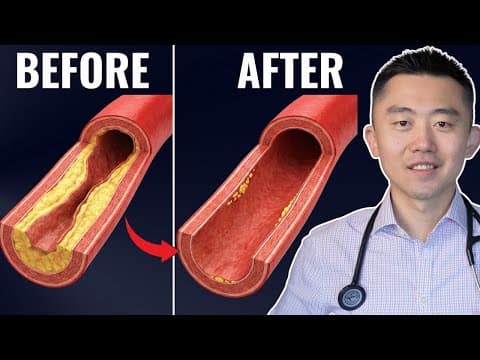 #1 Best Meal to UNCLOG Your Arteries (Backed by Science) thumbnail