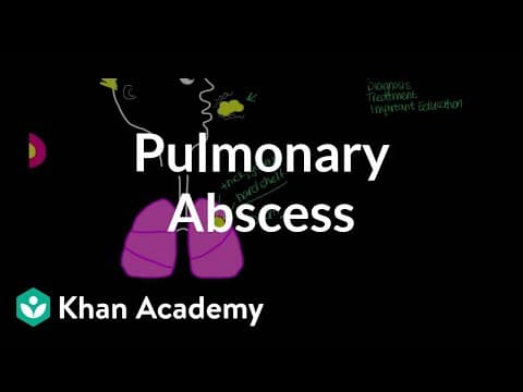 Pulmonary abscess | Respiratory system diseases | NCLEX-RN | Khan Academy thumbnail