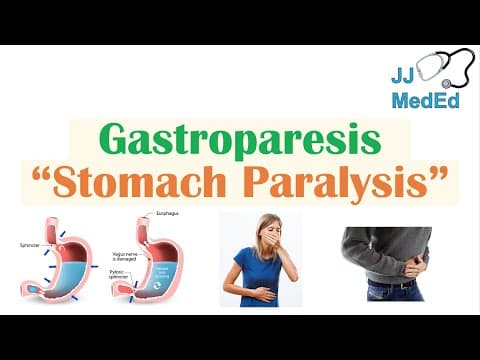 Gastroparesis (Stomach Paralysis) | Causes and Risk Factors, Signs & Symptoms, Diagnosis,  Treatment thumbnail