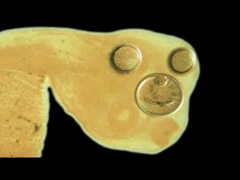 A Woman Ate Dark Web Bought Tapeworm Eggs To Lose Weight. This Is What Happened To Her Brain. thumbnail