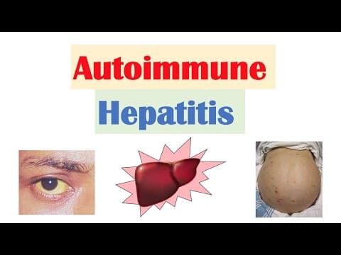 Autoimmune Hepatitis | Pathogenesis, Signs & Symptoms, Diagnosis, Treatment thumbnail