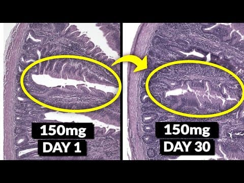 Study Proves You Only Need ONE SUPPLEMENT To Heal Leaky Gut (Not Glutamine!) thumbnail