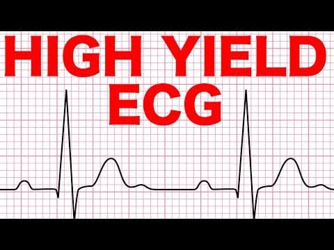 Electrocardiograms (ECG) Made Easy! thumbnail