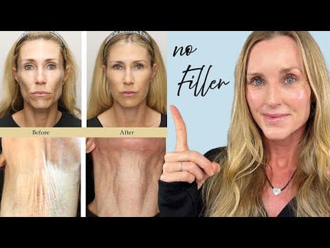 NATURALLY & PERMANENTLY Restore Facial Fat/Volume WITHOUT FILLER thumbnail