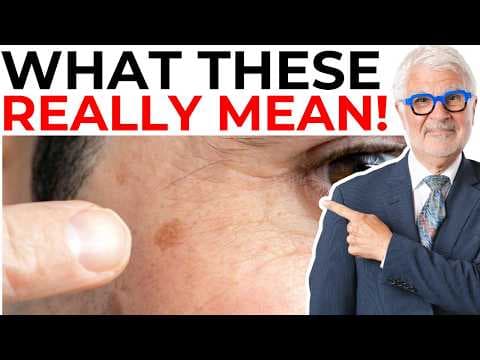 What Dark Spots on Your Skin Really Mean! thumbnail