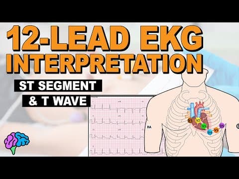 The ST Segment and T Wave REVIEW thumbnail