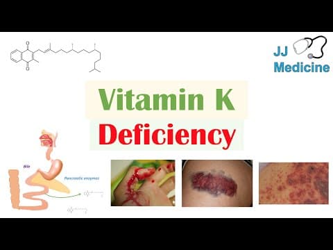 Vitamin K Deficiency | Dietary Sources, Causes, Symptoms, Diagnosis, Treatment thumbnail