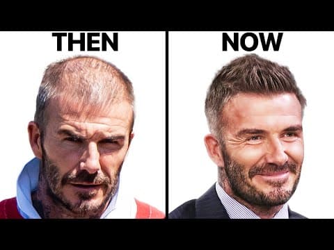 David Beckham: How He Stopped Hair Loss thumbnail