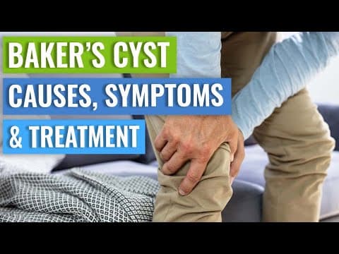 Baker's Cyst: How to Decide Whether You Need Surgery thumbnail