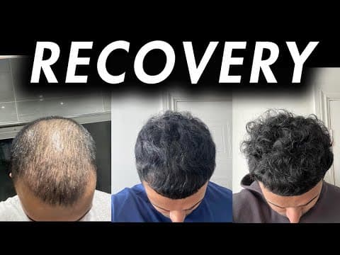 2 Year Hair Loss Recovery: DON'T WAIT thumbnail
