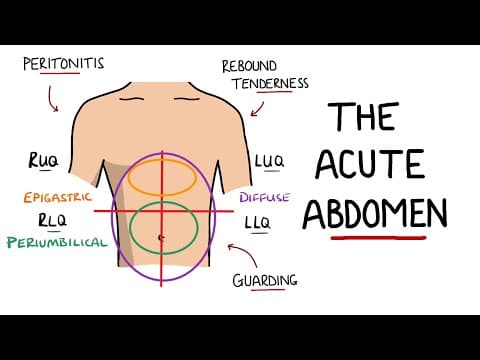 Acute Abdomen - A Structure to Acute Abdominal Pain thumbnail