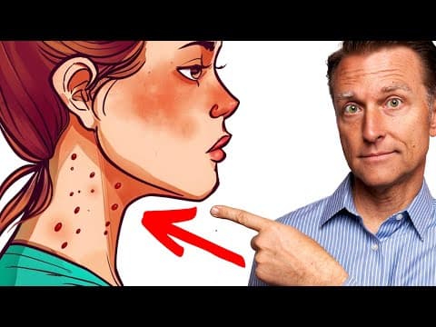 7 Signs You're Eating Too Much Sugar thumbnail