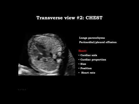 Cardiac Imaging in Early Gestation:  From Basic to Advanced thumbnail