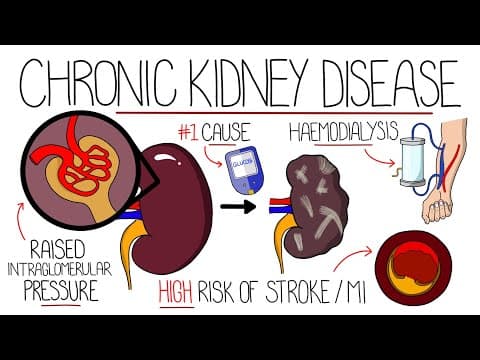 Understanding Chronic Kidney Disease (CKD) thumbnail