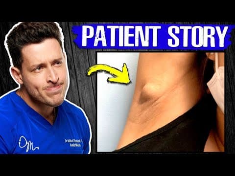 My Patient Thought it was Cancer… thumbnail