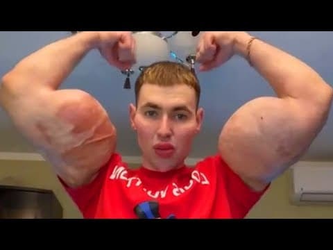 TikTok "Bodybuilder" Might Lose BOTH ARMS for "Looksmaxxing".. thumbnail