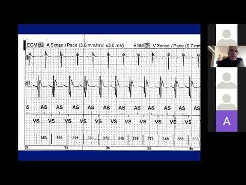 Orlov 5 14 20  Device EGM Cases thumbnail