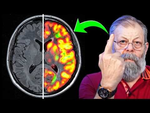 ПОКАЗЫВАЮ КАК ЗАТОРМОЗИТЬ СТАРЕНИЕ МОЗГА СВОИМ ПАЛЬЦЕМ thumbnail