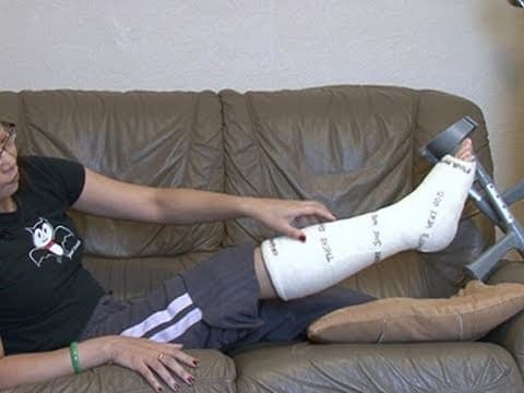 What Is Plaster of Paris and How Is It Used in Casts? thumbnail